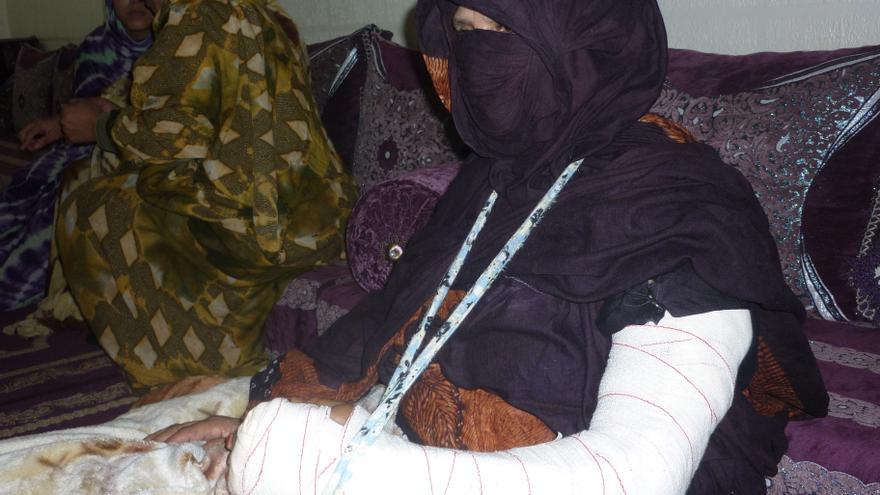 Mujer saharaui víctima de violencia tras el desmantelamiento del campamento de protesta saharaui de Gdeim-Izik por fuerzas marroquíes en noviembre de 2010. Foto de Amnistía Internacional