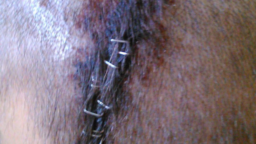 La herida causada en la cabeza de Zohuir