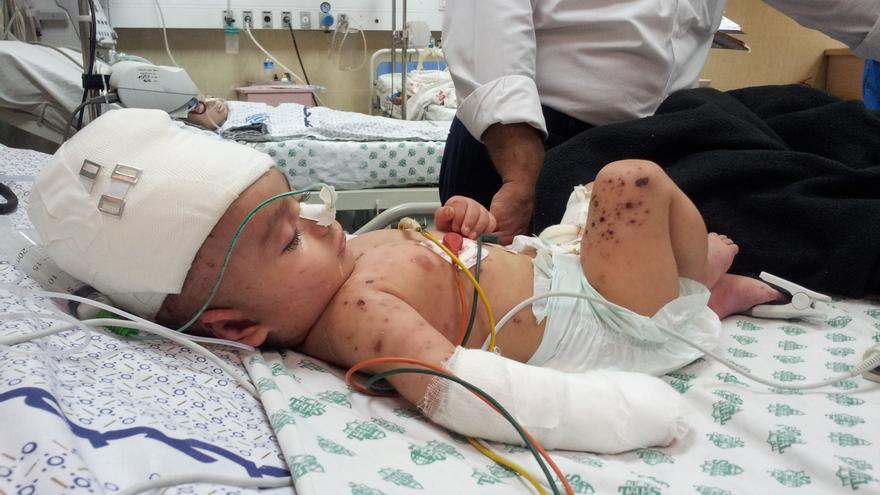 Bebé palestino herido por bombardeos israelíes durante operación militar israelí Margen Protector en 2014. | FOTO: Isabel Pérez.