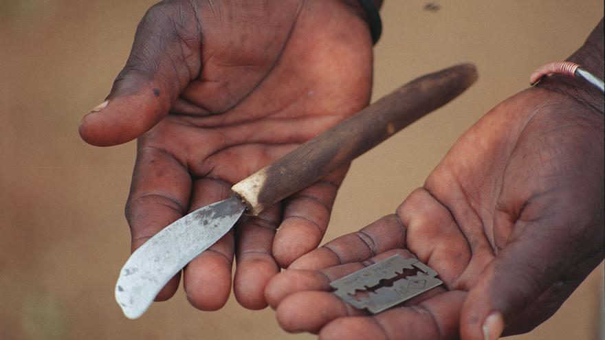 Las cuchillas con las que se practica la ablación/ Imagen cedida por World Vision
