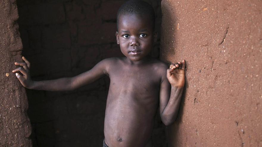 Gift tiene 5 años y vive en Malaui. Uno de cada nueve niños muere antes de cumplir cinco años en África subsahariana. La diarrea, la malaria y la neumonía causan más de la mitad de las muertes infantiles en esta parte del mundo. En 2011, casi siete millones de niños menores murieron en el mundo, la mayor parte de enfermedades prevenibles. (Graeme Robertson/ActionAid)