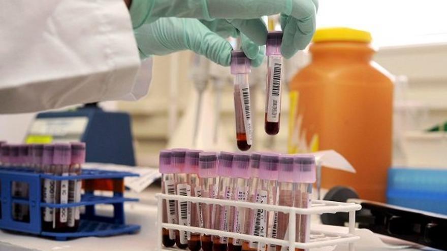 EEUU aprueba la primera terapia génica contra la leucemia linfoide