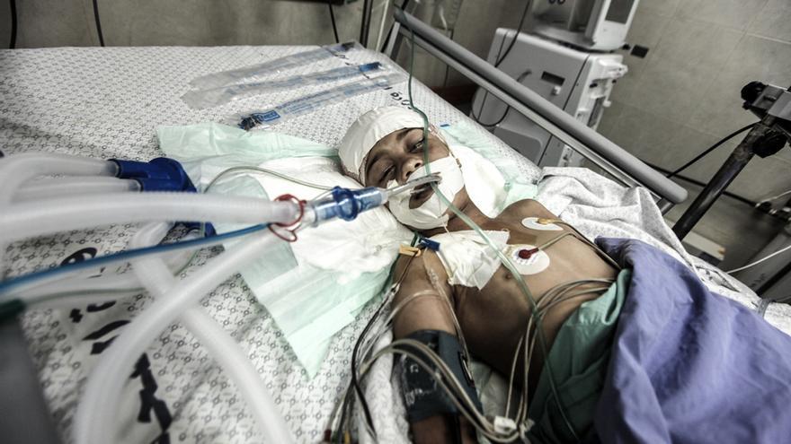 Un nio herido hospitalizado en Ciudad de Gaza por un ataque israel del 10 de julio. Foto: Momen Faiz/Zuma Press