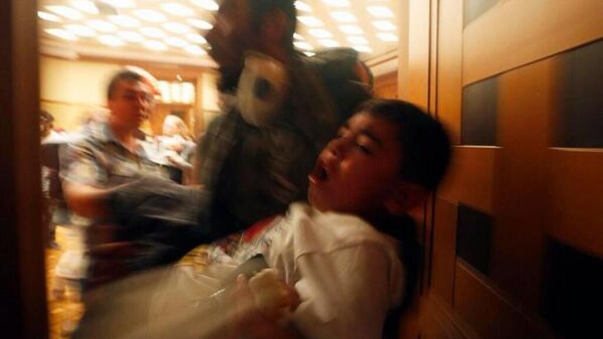 Un niño afectado por las cargas con gas en el Hotel Divan / @ilkimm