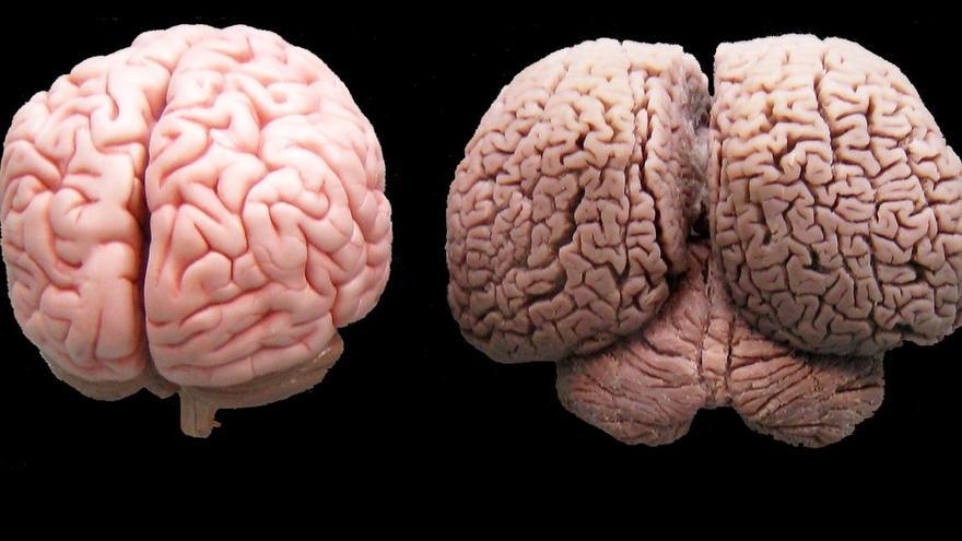 Cerebro humano y cerebro de delfín