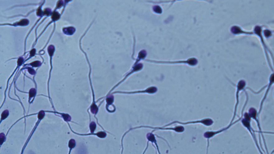 La concentración de espermatozoides en los hombres occidentales se está reduciendo